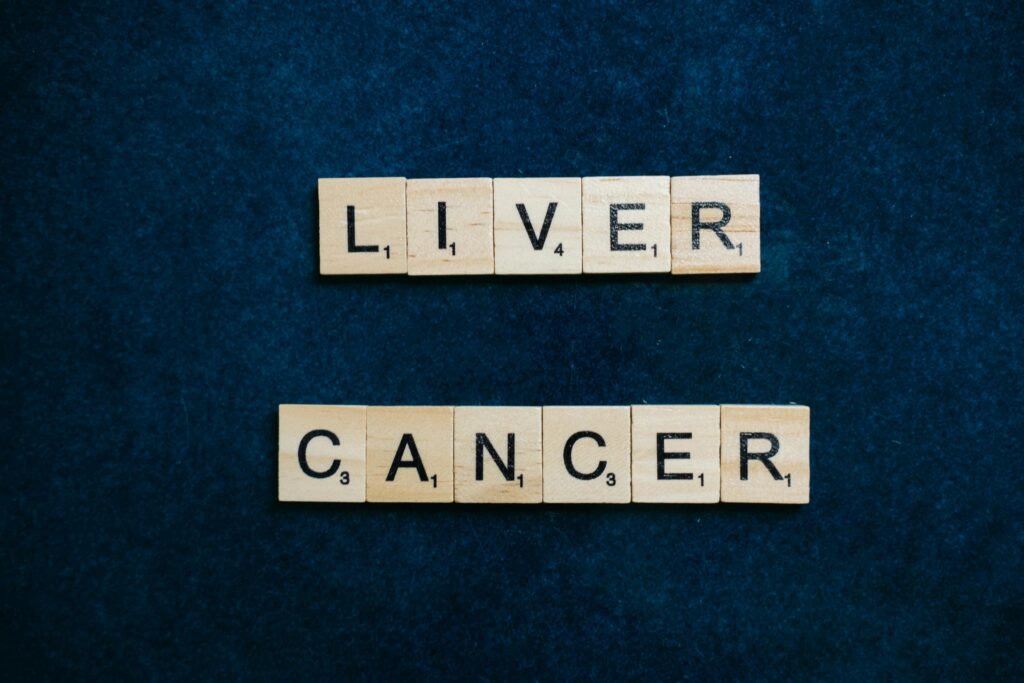 Scrabble tiles spell out 'Liver Cancer' on a dark blue background, symbolizing awareness.